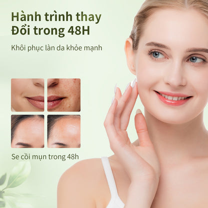 ANPN Acne Spot Treatment Cream